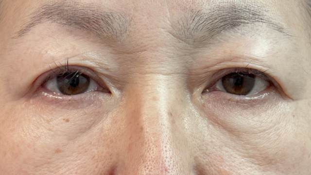 手术前的状态 其一