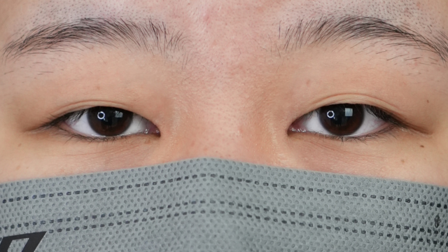 手术前的状态 其一