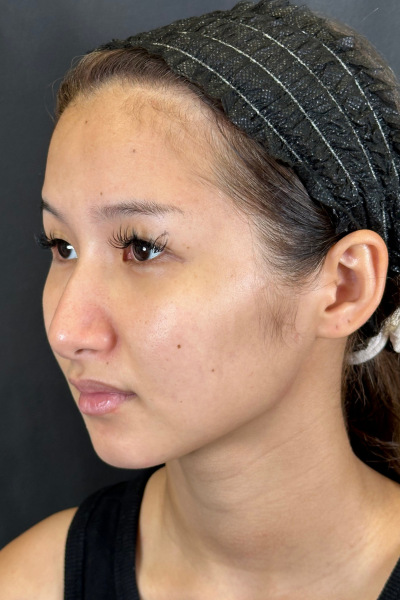 Postoperative Condition Part 1