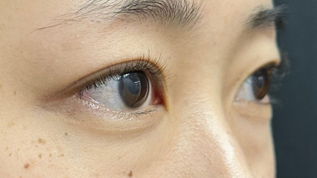 手术前的状态 其一