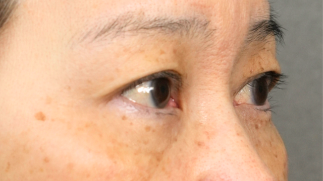 Postoperative Condition Part 1