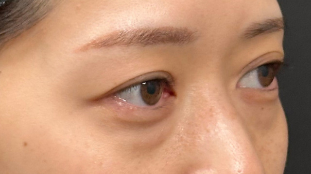 手術前の状態 その1