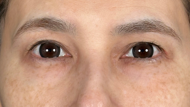 手术前的状态 其一