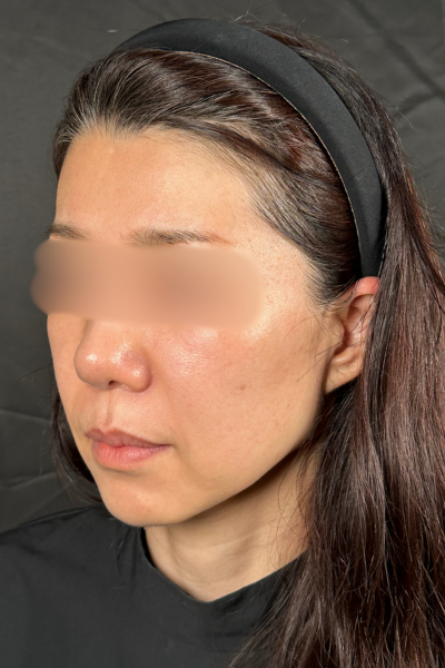 Postoperative Condition Part 1