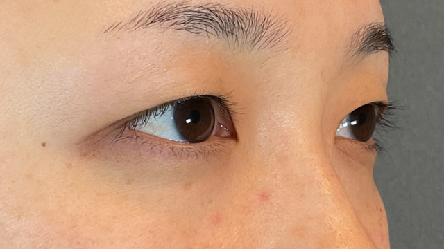 手术前的状态 其一