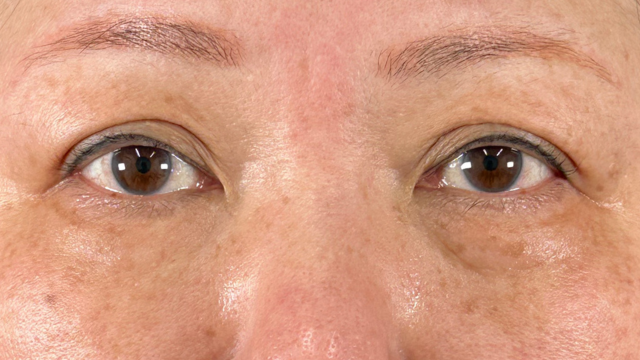 Postoperative Condition Part 1