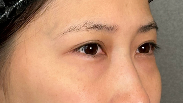 Postoperative Condition Part 1