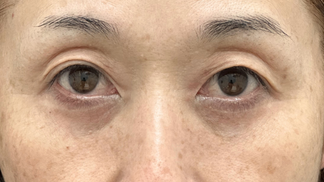 手术前的状态 其一