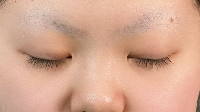 手术前的状态 其一