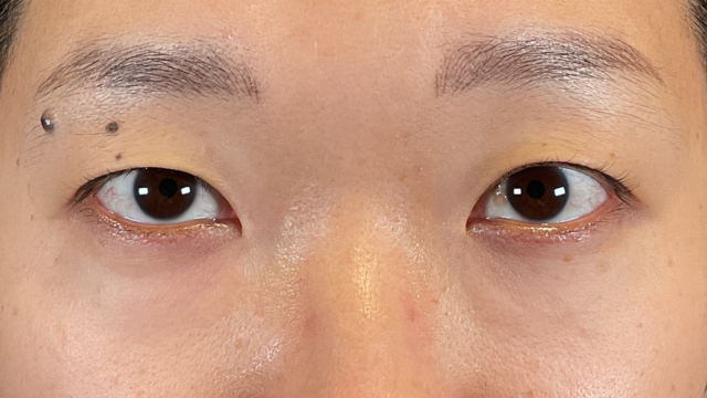 Postoperative Condition Part 1