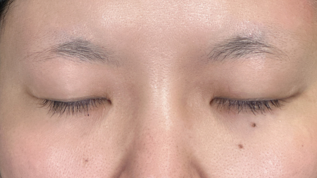 手术前的状态 其一