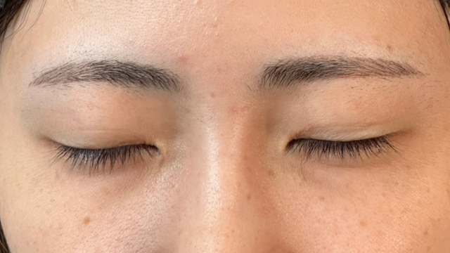 Postoperative Condition Part 1