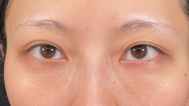 手术前的状态 其一