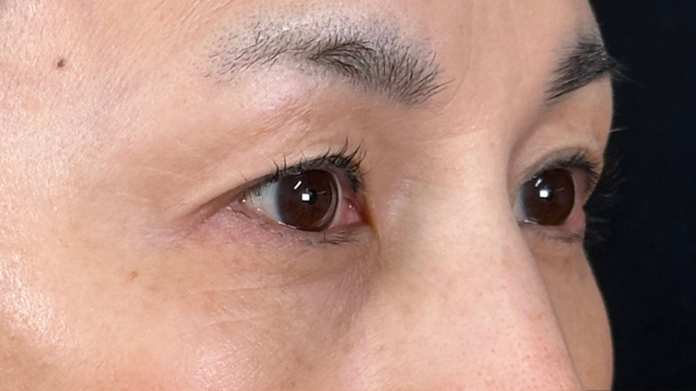 手術前の状態 その1