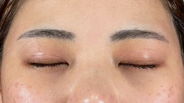 Postoperative Condition Part 1