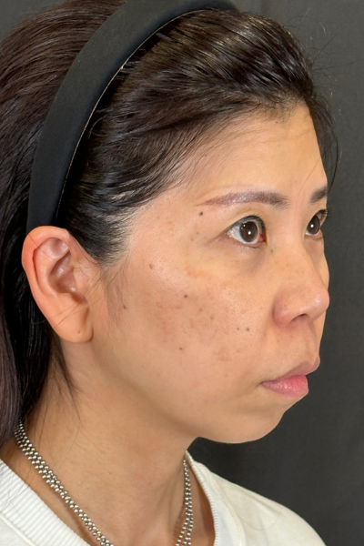 手术前的状态 其一