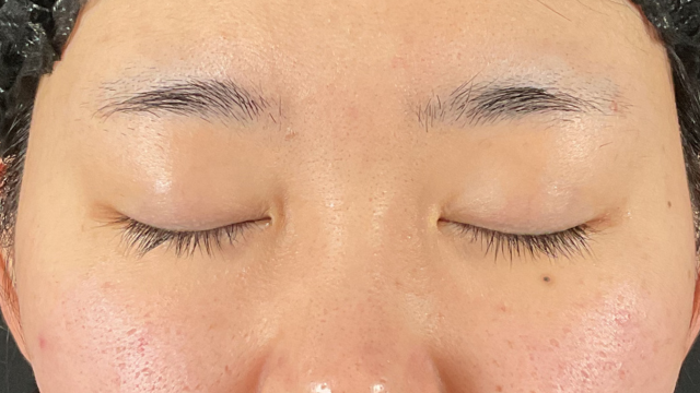 手术前的状态 其一