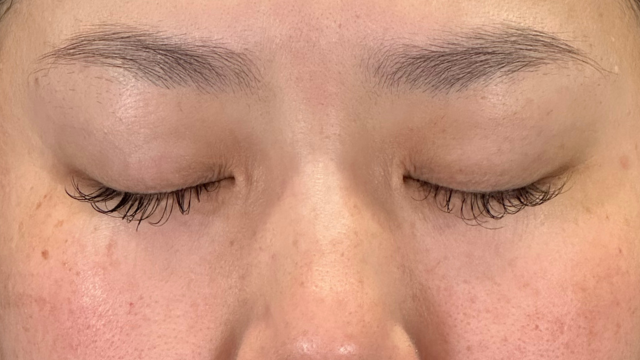 手术前的状态 其一