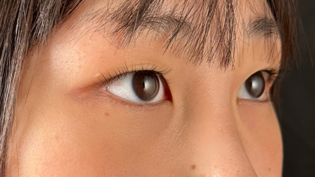 手术前的状态 其一