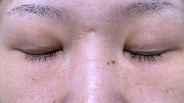 Postoperative Condition Part 1