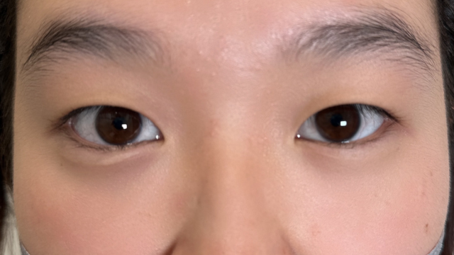 手术前的状态 其一