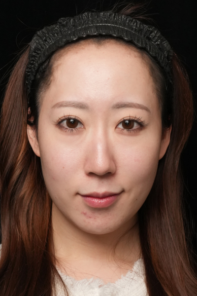 手術前の状態 その1