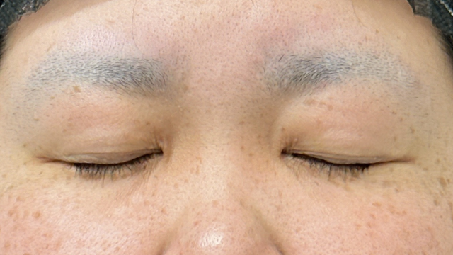 Postoperative Condition Part 1