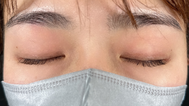 手术前的状态 其一