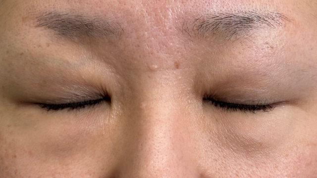 Postoperative Condition Part 1