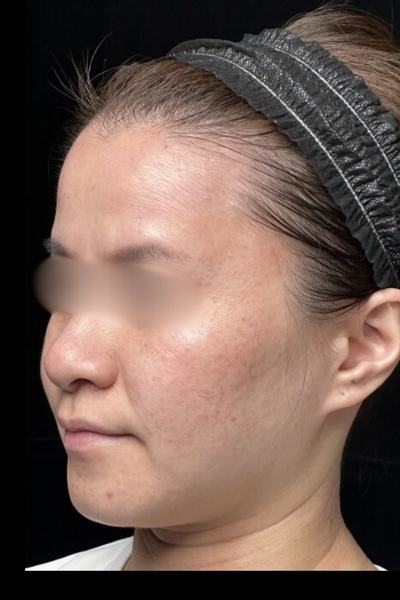 手術前の状態 その1