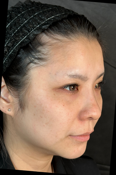 Postoperative Condition Part 1