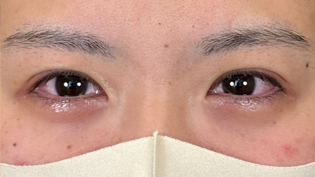 Postoperative Condition Part 1