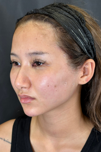 Postoperative Condition Part 1