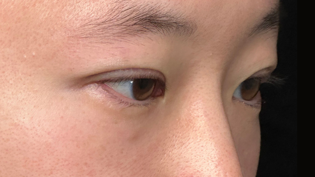 Postoperative Condition Part 1