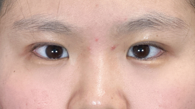 手术前的状态 其一