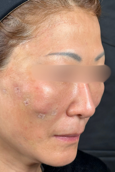 手术前的状态 其一