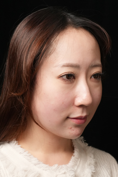 手術前の状態 その1