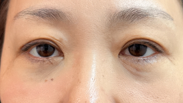 Postoperative Condition Part 1