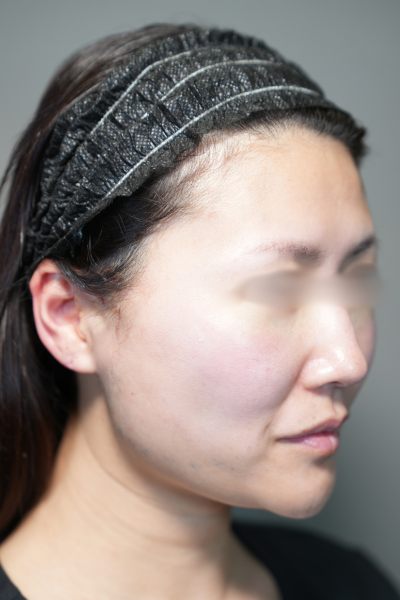 手術前の状態 その1