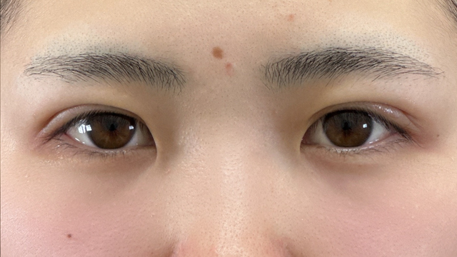 Postoperative Condition Part 1