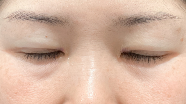 手术前的状态 其一