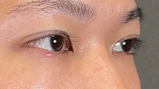 Postoperative Condition Part 1