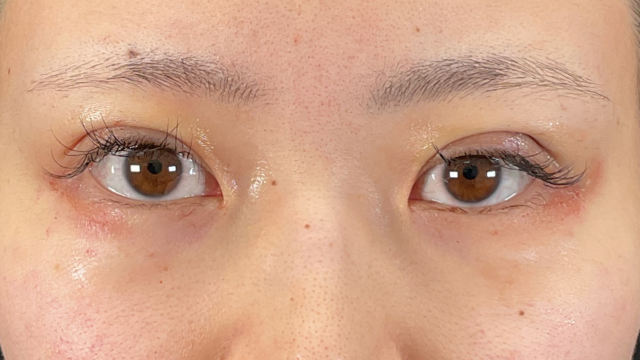 手术前的状态 其一