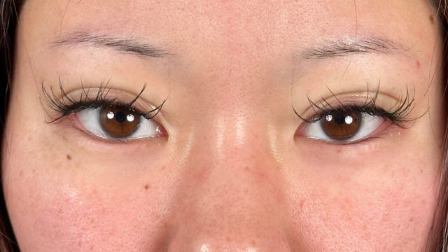 手术前的状态 其一