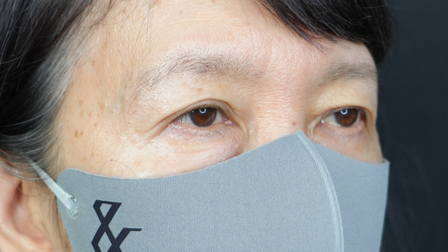 手术前的状态 其一