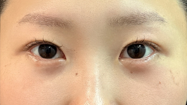 手术前的状态 其一