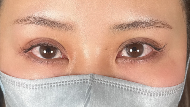 手术前的状态 其一