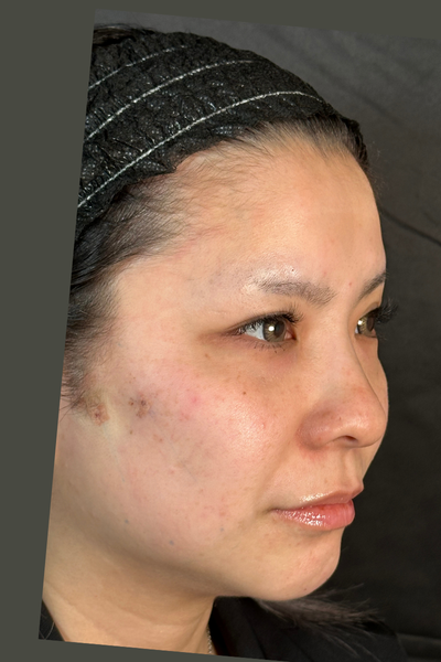 Postoperative Condition Part 1