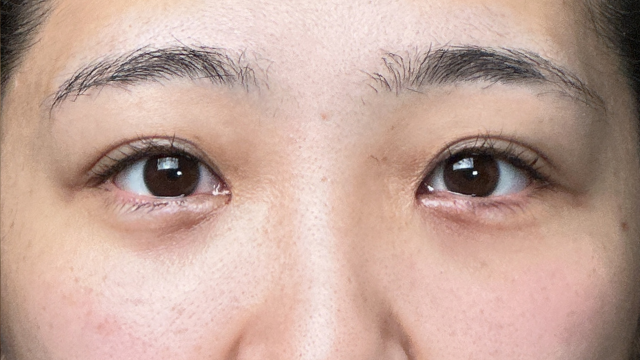 Postoperative Condition Part 1