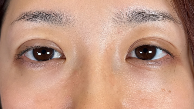 手术前的状态 其一